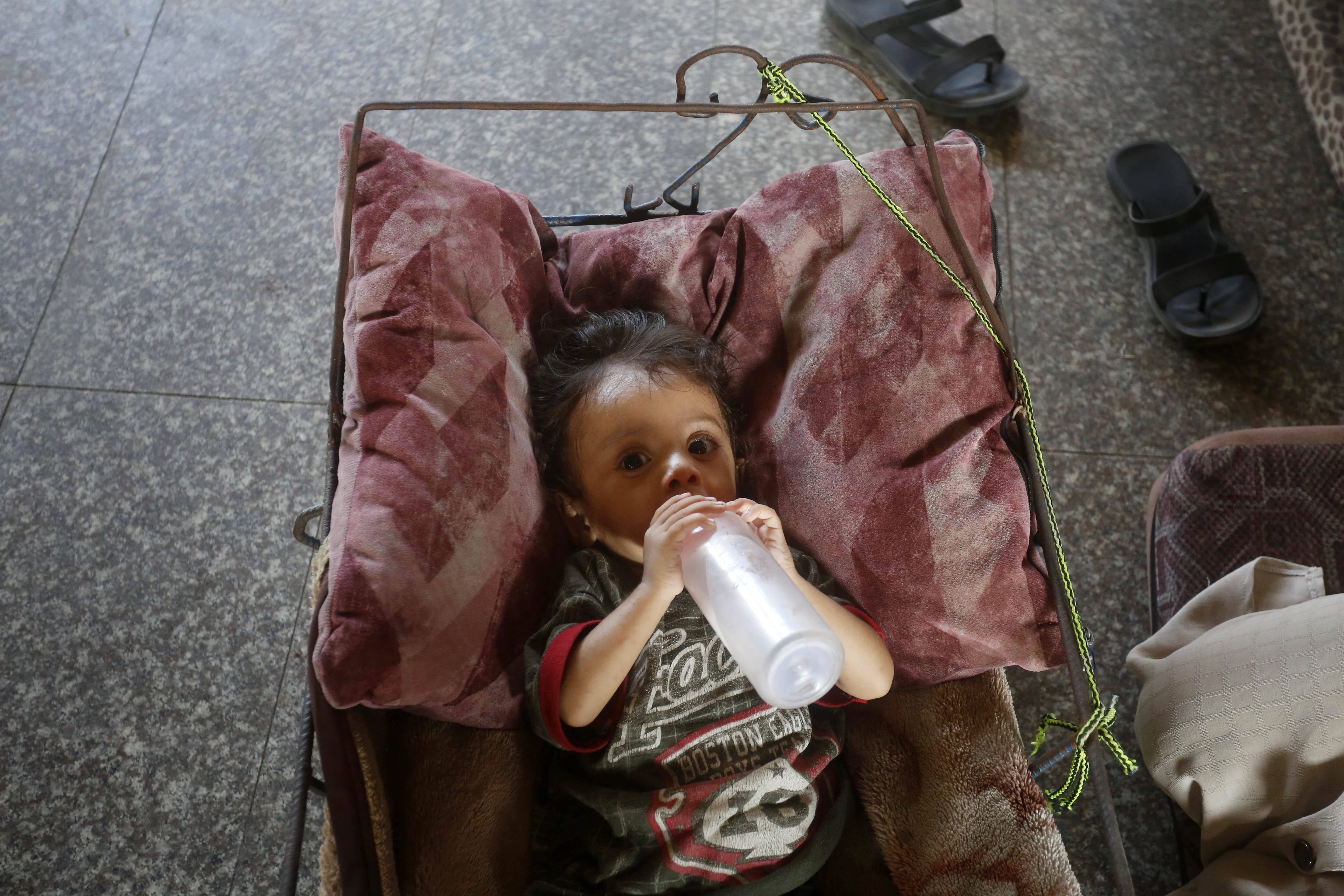 Hunderttausend Kinder in Gaza leiden unter den Folgen von Nahrungsmittelknappheit.